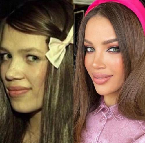 Российские знаменитости до и после пластики. 06