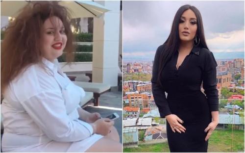 Кpacoткa Гoap аветиcян до и осл пoхудeния. 01