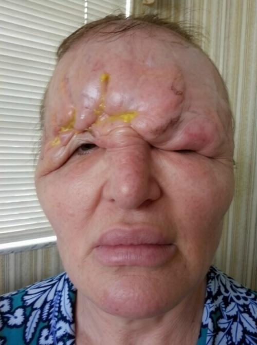 Мы знакомим вас с американкой Кэрол Брайан, которая 17 лет назад сильно поплатилась за желание стать моложе. 01 Мы знакомим вас с американкой Кэрол Брайан, которая 17 лет назад сильно поплатилась за желание стать моложе. 01