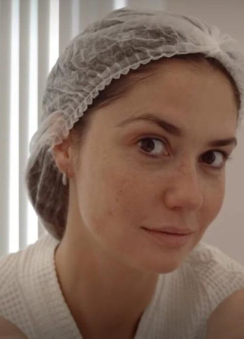 Агата муцениеце решила не отставать от модных бьюти - тенденций и попробовала одну из самых обсуждаемых процедур этого сезона.  