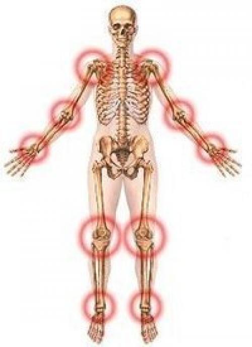 Про суставы.  У вас проблема с суставами. 01