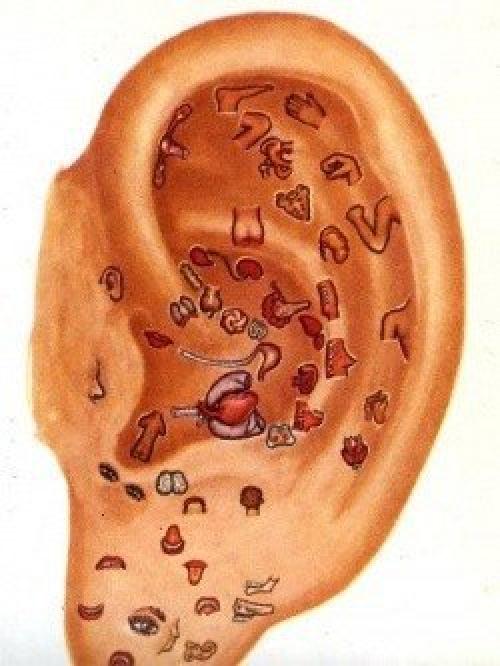 Диагностика организма по ушным раковинам. 

