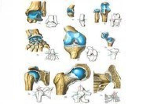 Про суставы.  У вас проблема с суставами. 02