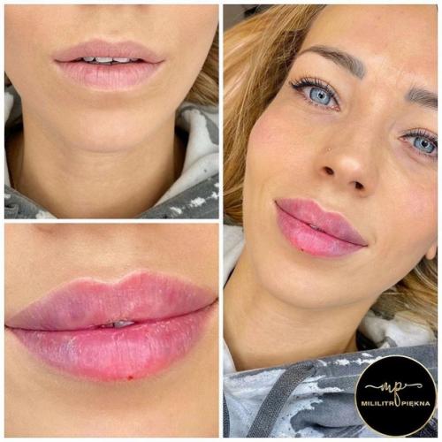 Аккуратные и красивые губы так выглядят. 09