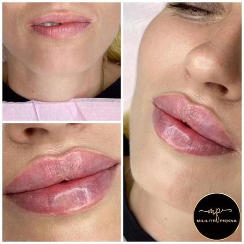 Аккуратные и красивые губы так выглядят. 08
