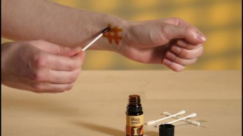 Йодовая сетка: целебные свойства простых линий.