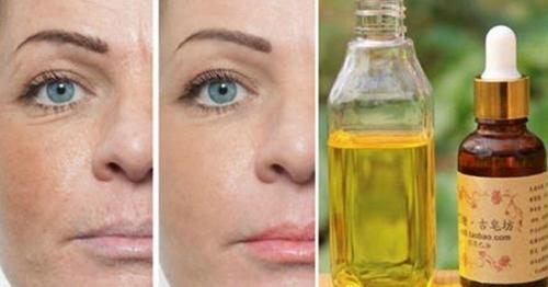 Касторовое масло от мимических морщин. Касторовое масло от мимических морщин.