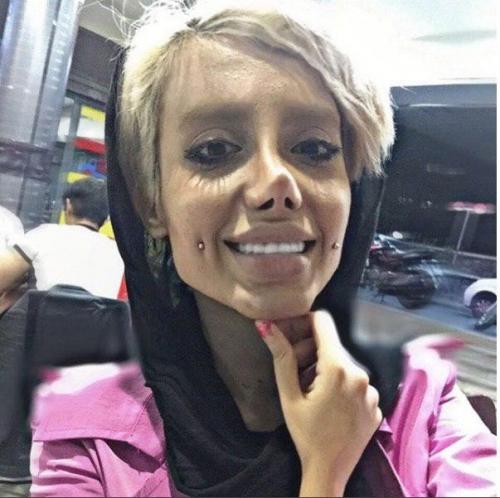 Какой ужас. Эта девушка сделала 50 операций, чтобы быть похожей на Анджелину Джоли. 04