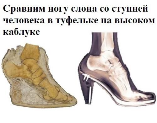 Слоновьи стопы напоминают пятки благодаря уникальному способу их костей и мягких тканей поддерживать огромный вес. 
