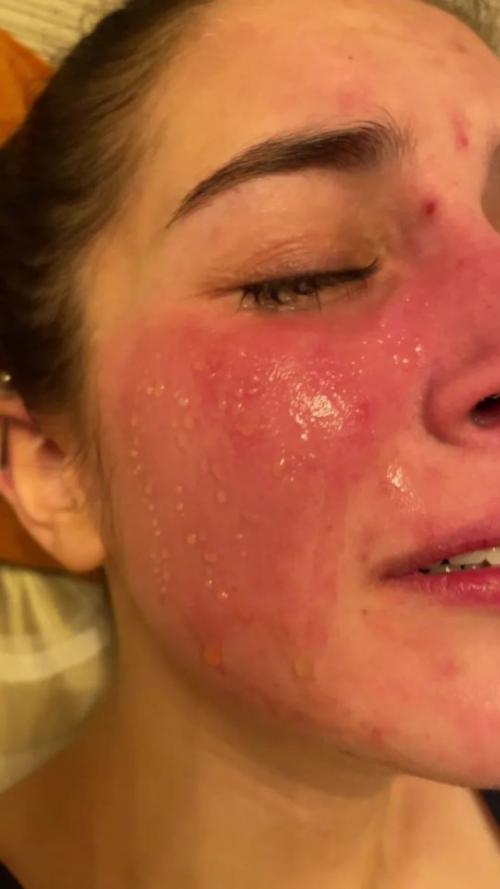 Бет цангаридес посетила сотни медицинских приемов, но врачи по-прежнему остаются в недоумении спустя шесть лет. 02