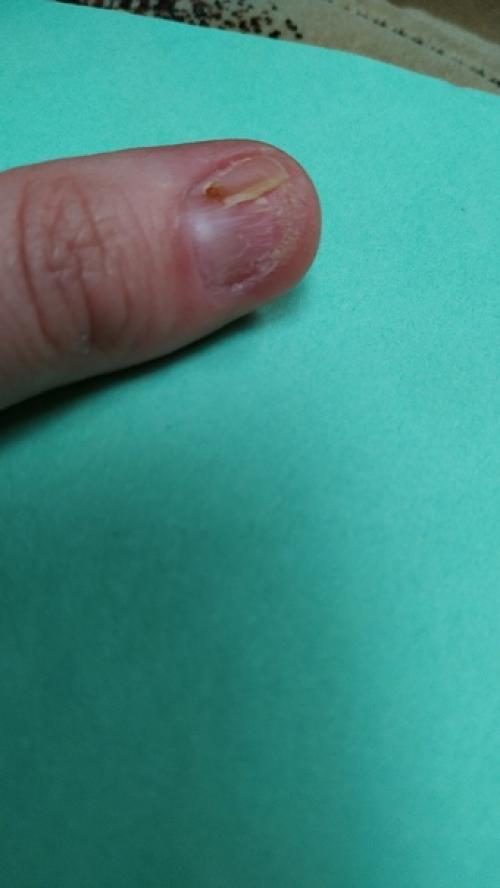 ДД!  Эта проблема началась 2 года назад. 01