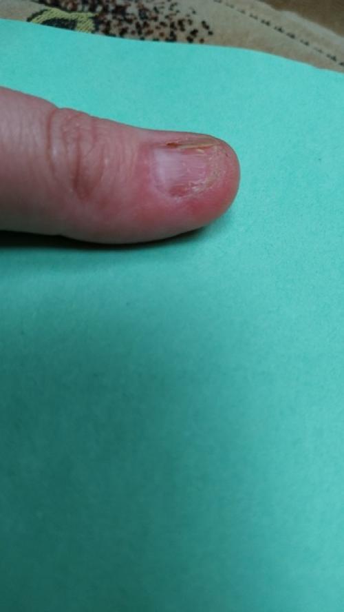 ДД!  Эта проблема началась 2 года назад. 02