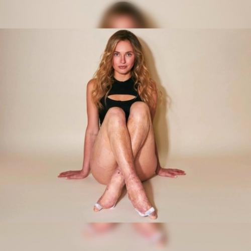 В аэропорту девушку в инвалидном кресле унизили и отказались помочь даже с базовыми задачами. 01