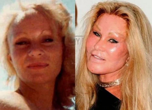 Умерла знаменитая Жертва Пластической Хирургии джоселин вильденштейн, известная как женщина - кошка. 03