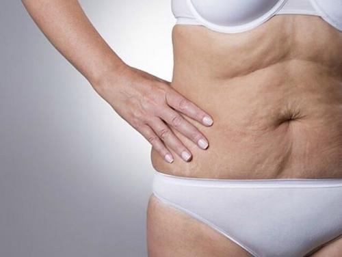 Морщинистая шея, дряблые руки и рыхлые бедра в прошлом!  