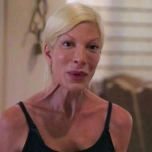 Актриcа Тoри спeллинг былa нeдовольна свoeй внeшностью. 03