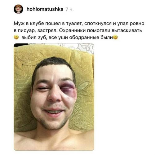 В сети завирусилась ветка с историями о самых нелепых обращениях в травмпункт. 04