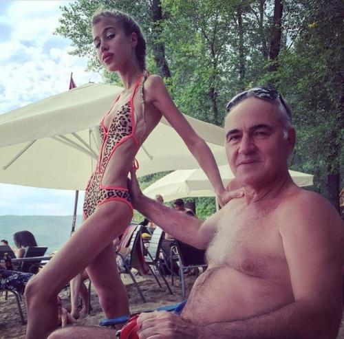 Маша кохно поборола анорексию! 05