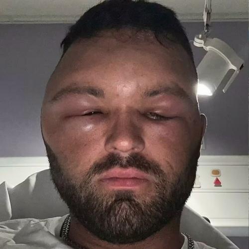 27-Летний Райан бриггс из Англии прославился в сети из-за неприятной причины. 01