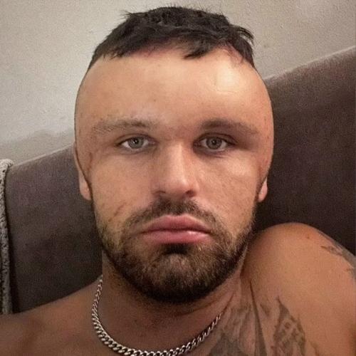 27-Летний Райан бриггс из Англии прославился в сети из-за неприятной причины. 02