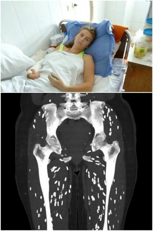 Адские мучения из-за кусочка суши.
