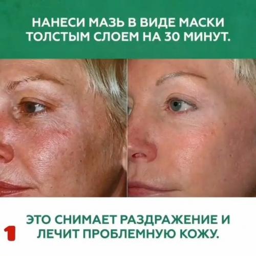 Копеечные средства для красоты из аптеки. 02