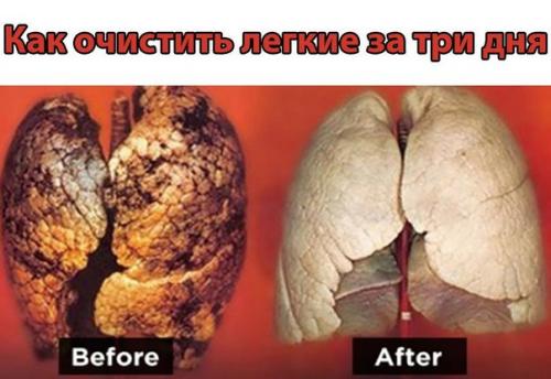 Как очистить легкие за три дня. 

