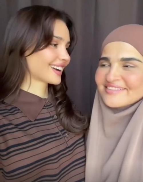 Блогер и певица Дина саева показала преображение своей мамы после пластической операции. 02