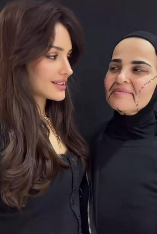 Блогер и певица Дина саева показала преображение своей мамы после пластической операции. 01