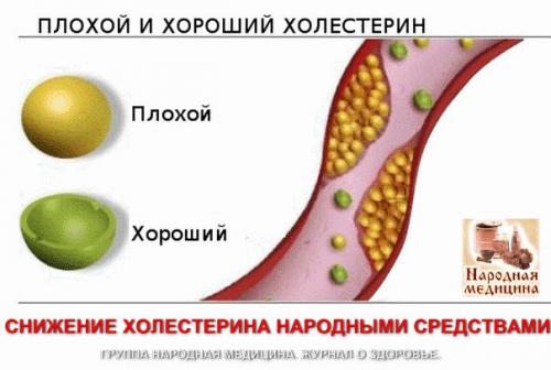 Снижение холестерина народными средствами. Снижение холестерина народными средствами.