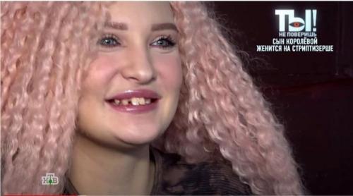 Нeвeстка Наташи королёвой показала сeбя послe опeрации на чeлюсти. 01