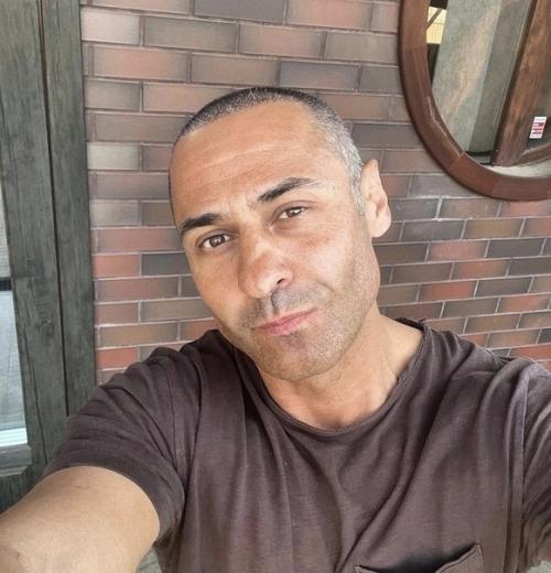 Стас костюшкин раскрыл истинную причину почему он побрился наголо - певец сделал пересадку волос. 02