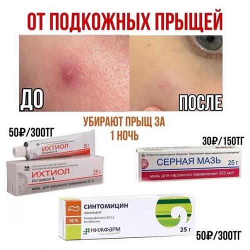 Лучшее средство от акне. 01