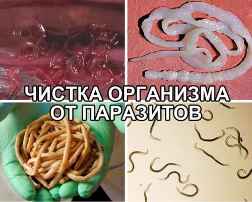 Очищение организма от паразитов. Очищение организма от паразитов.