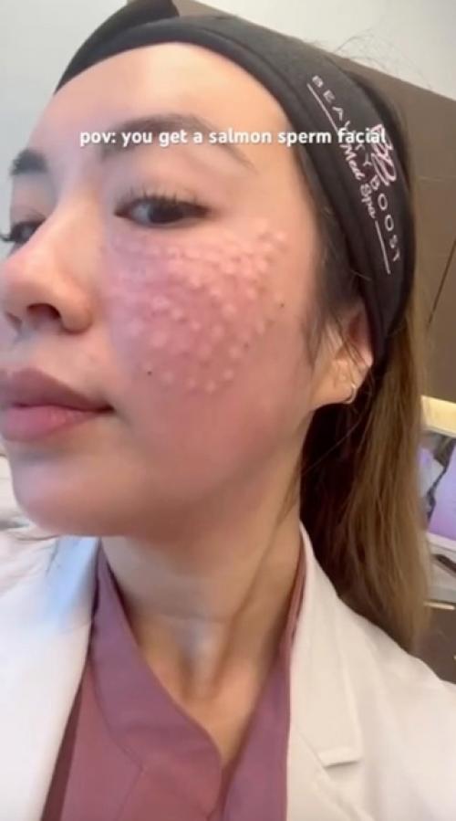 У звезд новая бьюти - процедура - Ким кардашьян рассказала, что колола в лицо. 01