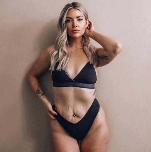 Многие девочки скрывают свой целлюлит, растяжки, обвисший животик и это не есть нормально. 05