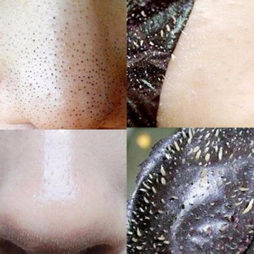 Маски которые с активированным углем очищают. Маски которые с активированным углем очищают.