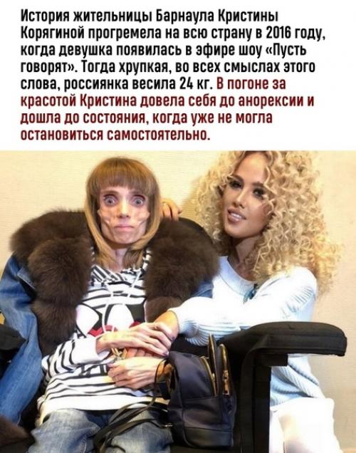 Выбраться живым из схватки с анорексией крайне сложно. 01