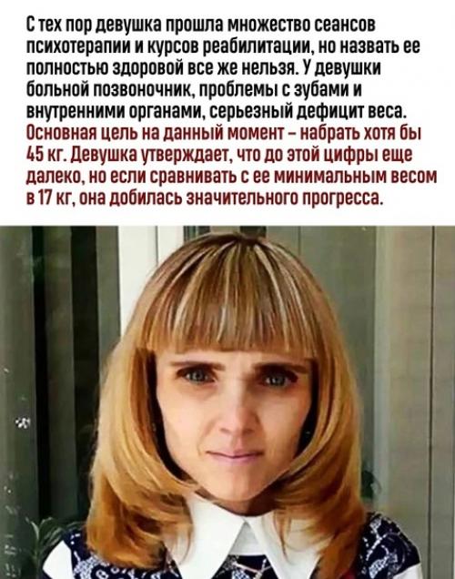 Выбраться живым из схватки с анорексией крайне сложно. 02