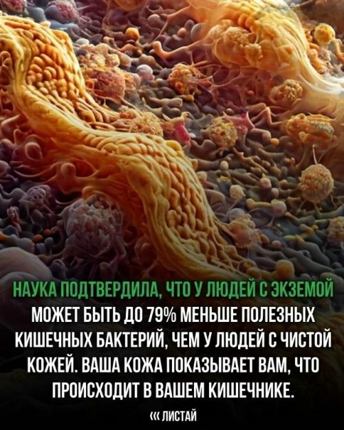 Утверждение о том, что экзема начинается в кишечнике и что люди лечат не тот Орган, не подтверждается современными научными данными. 01