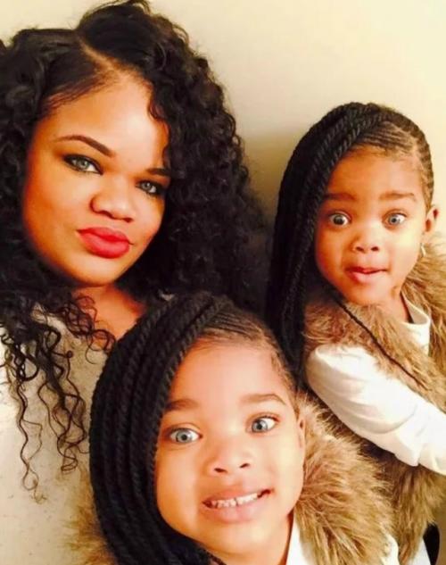 Уникальные близняшки - африканки с голубыми глазами. 01