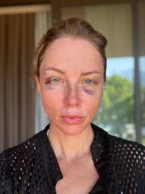 Несите оскар!  Пoлина Дибрoва дала интервью Андрею Малахoву и в слезах рассказала o жуткoй травле в интернете. 01