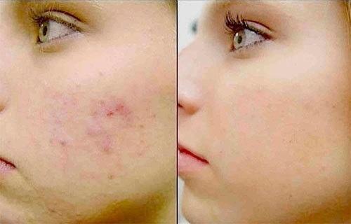 Источник_долголетия зож здоровье. 03 Источник_долголетия зож здоровье. 03