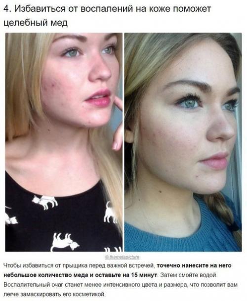 Советы косметолога. Жми Слушать. 03