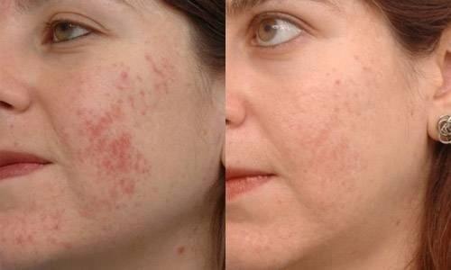 Источник_долголетия зож здоровье. 02 Источник_долголетия зож здоровье. 02