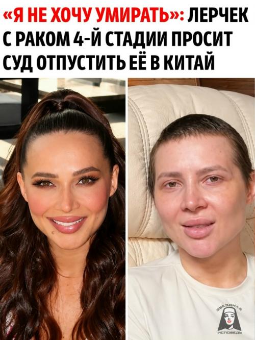После девяти курсов химиотерапии лерчек сообщила страшную новость: рак желудка четвёртой стадии снова начал прогрессировать.  