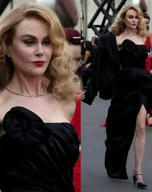 Николь кидман открыла показ Vogue World в голливуде и спровоцировала слухи о злоупотреблении уколами красоты. 
