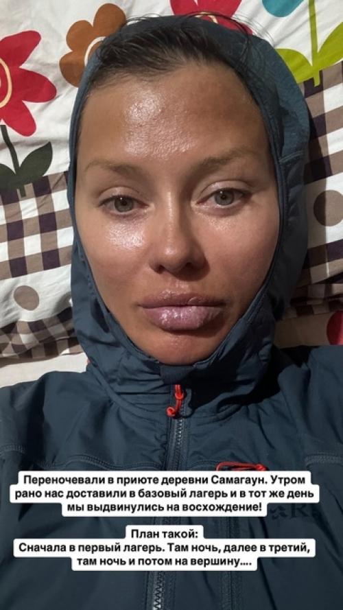 Вика боня прилетела в Москву, чтобы сделать губы и лицо более красивыми. 03