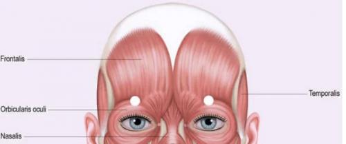 Нависшие веки?  Как их поднять? 01 Нависшие веки?  Как их поднять? 01