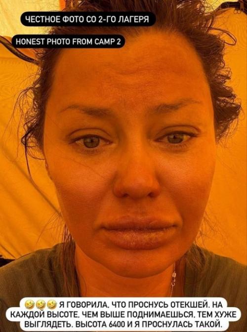 Вика боня прилетела в Москву, чтобы сделать губы и лицо более красивыми. 02